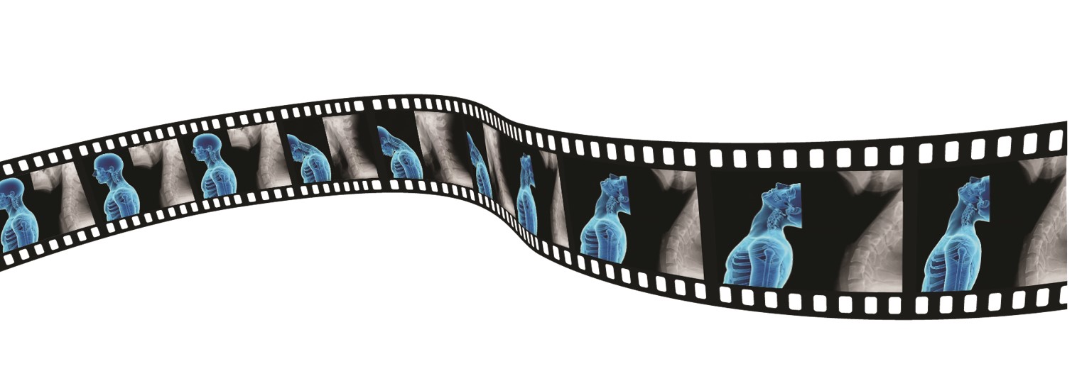 filmstrip of x-ray images