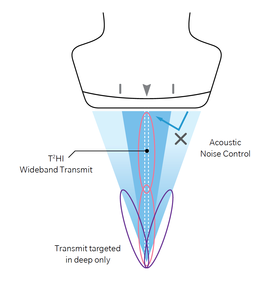 diagram of sonimage HS2 dual sonic technology