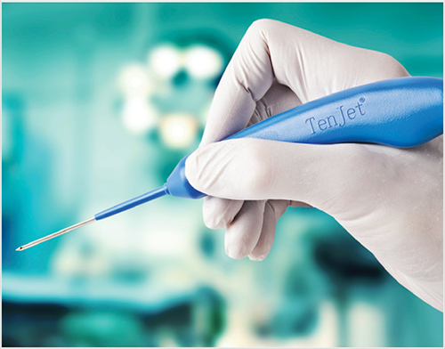 TenJet ultrasound guided needle