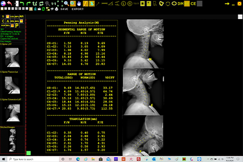 Opal-Chiro Pennings Analysis scree