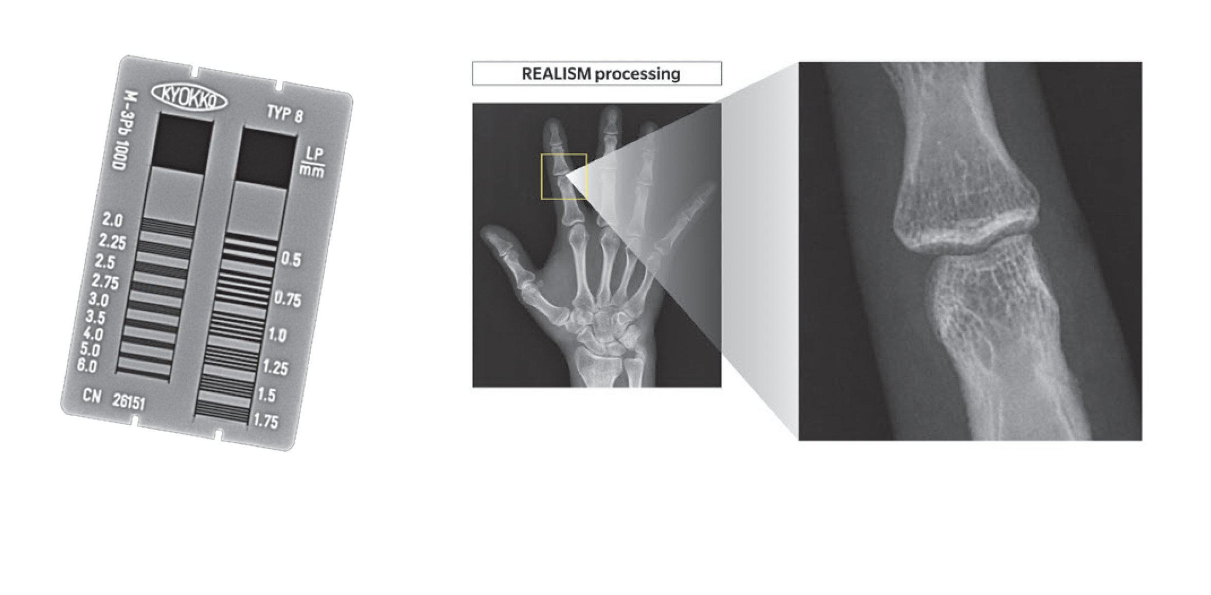 AeroDR GL - Realism processing example